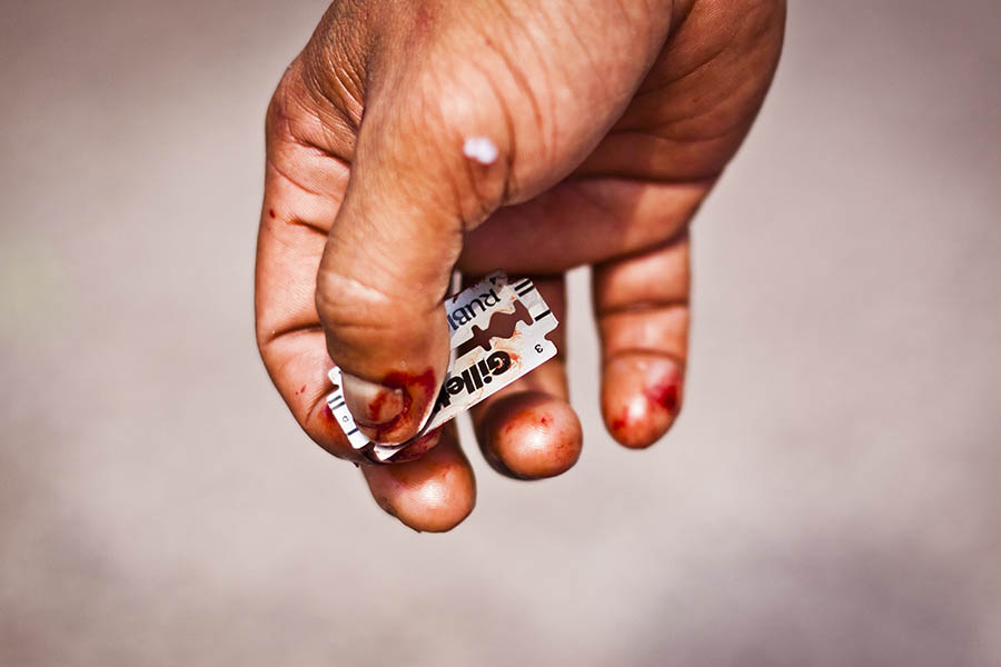 A man holds a razor blade, used for cutting celebrants’ backs, in Angeles, The Philippines.